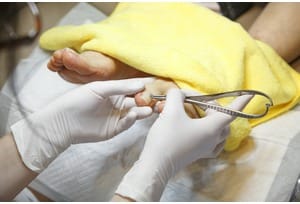 Thumb pc medical flesh fc